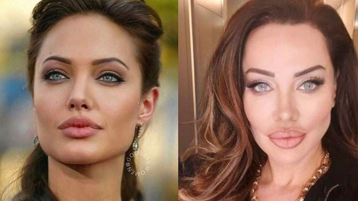 Angelina Jolie'ye Benzemek için Türlü Estetikler Yaptıran Umut Akyürek'in Parmak Isırtan Pozlar