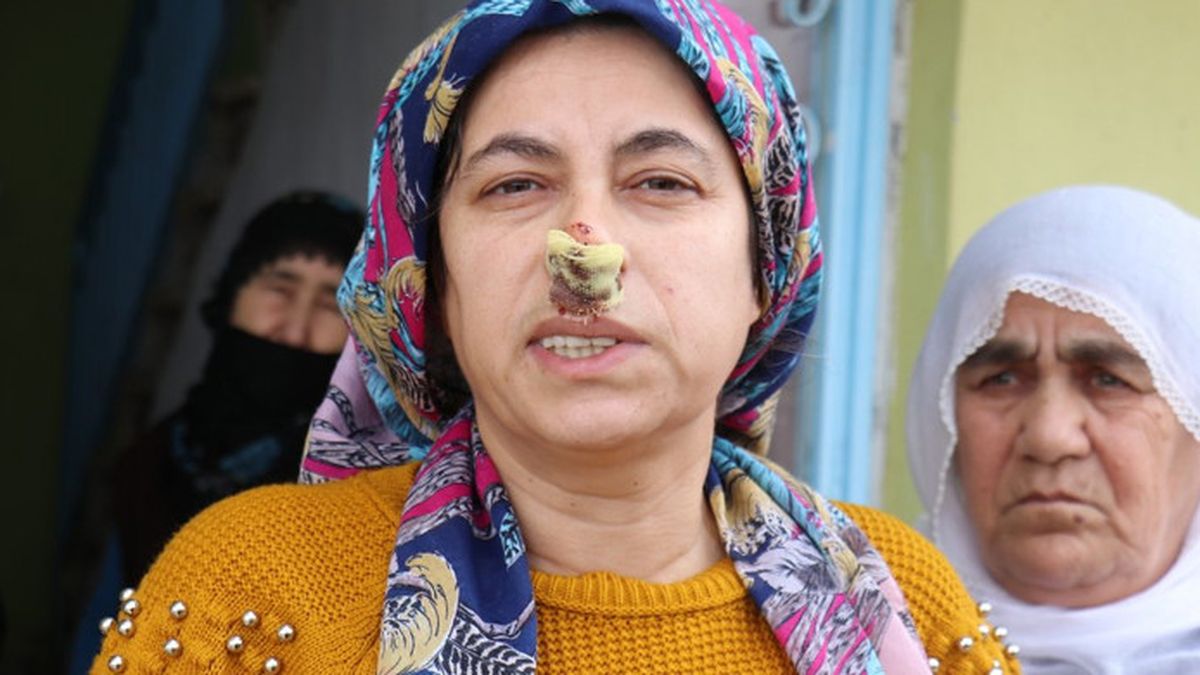 Malatya'da 8 Köpeğin Bir Kadına Saldırdığı Anlar
