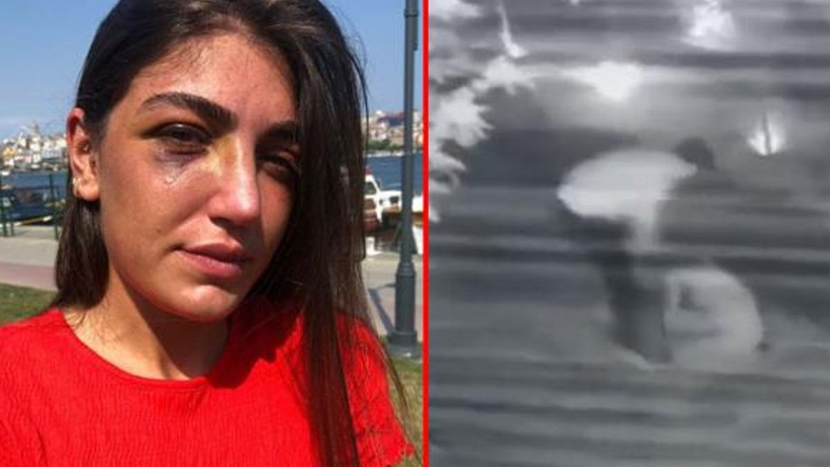 Manken Gizem Akbaş Tarafından Eski Sevgilisi Darp Edildi