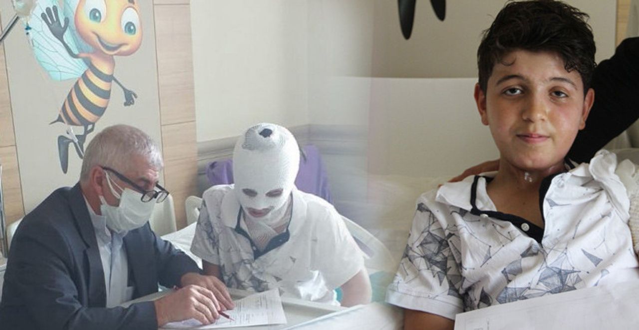 Erzurum’da Üzerine Kaynar Su Dökülen Çocuk Tedaviye Alındı564465 Erzurum’da Üzerine Kaynar Su Dökülen Çocuk Tedaviye Alındı564465