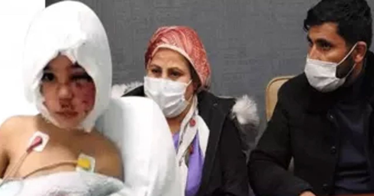 Pitbull saldırısına uğrayan asinin babası işsiz kaldı Pitbull saldırısına uğrayan asinin babası işsiz kaldı