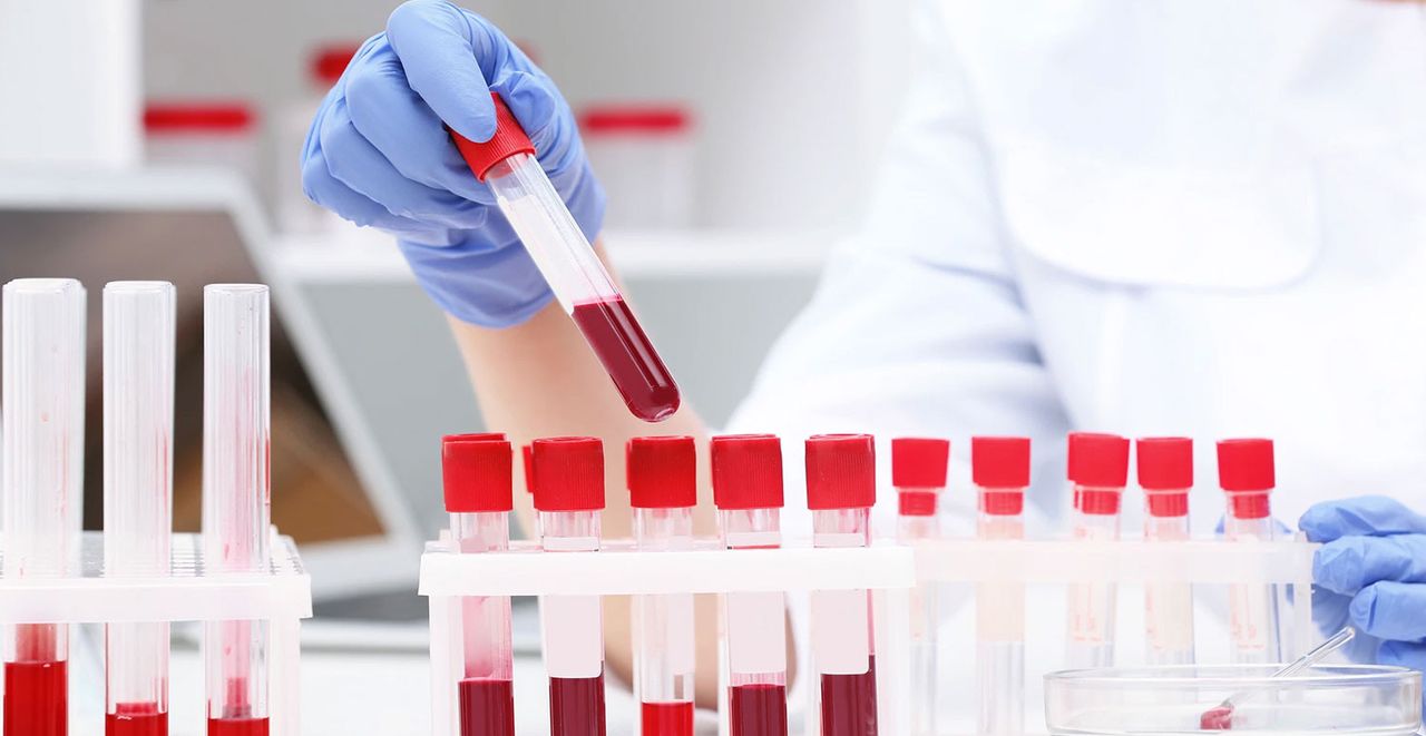 CRP TESTİ CRP TESTİ