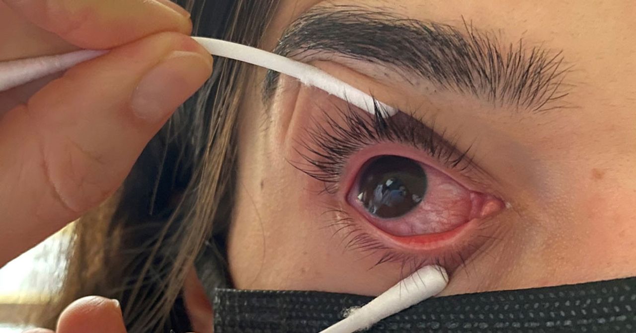 Adenovirs nedir etkileri nelerdir Adenovirs nedir etkileri nelerdir