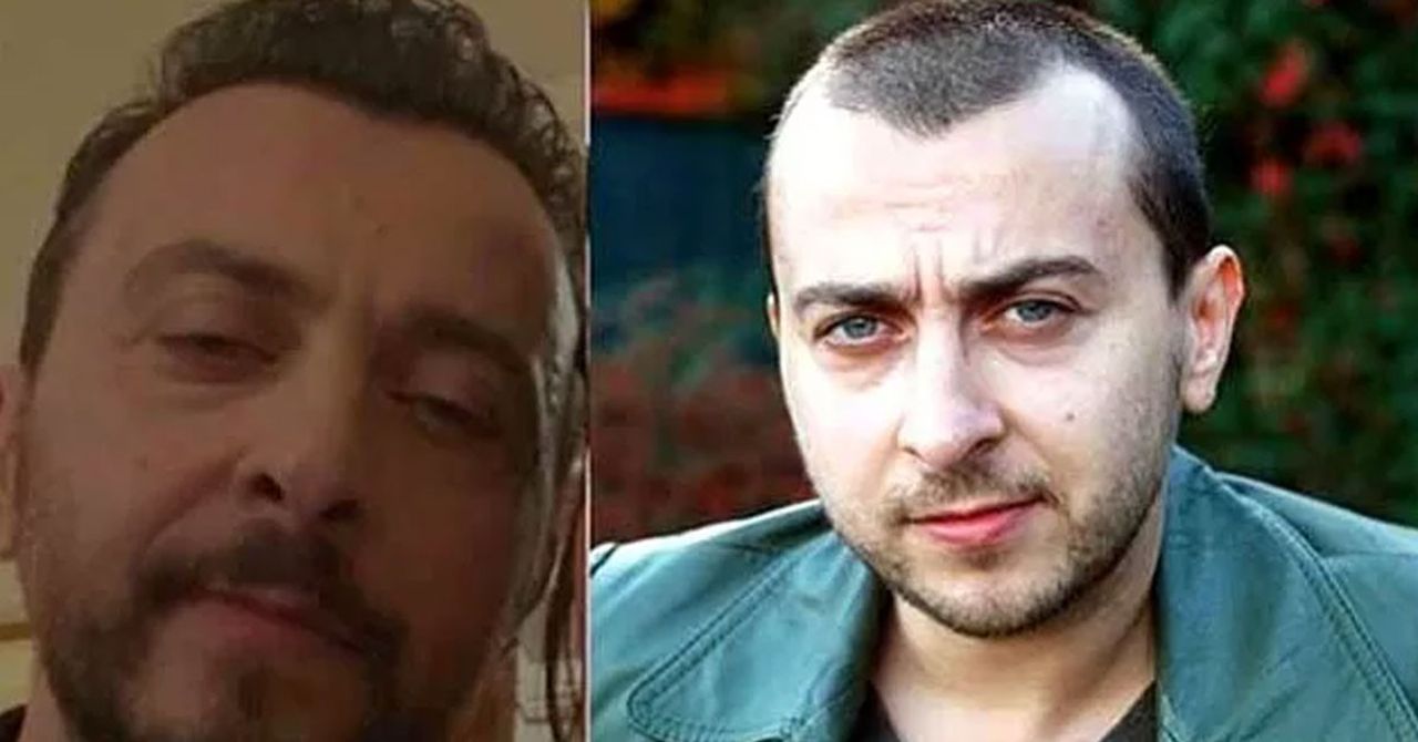Ali Atay saç ektirdi Ali Atay saç ektirdi
