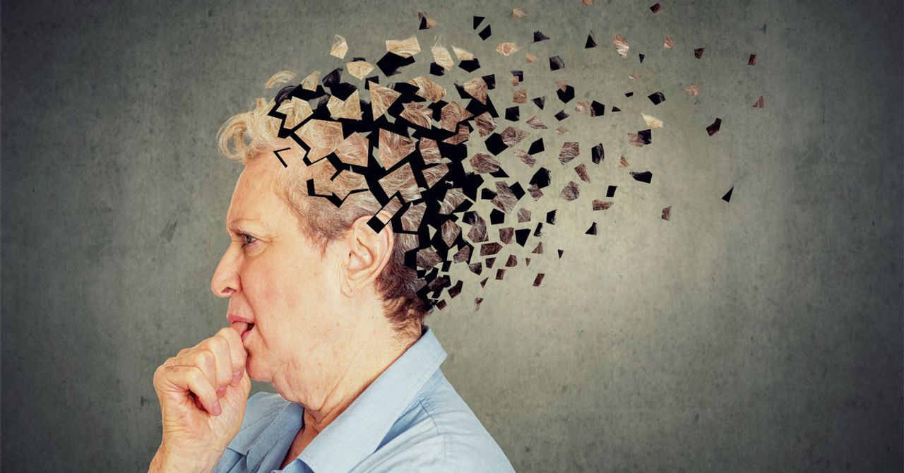 Alzheimer tedavisi Alzheimer tedavisi