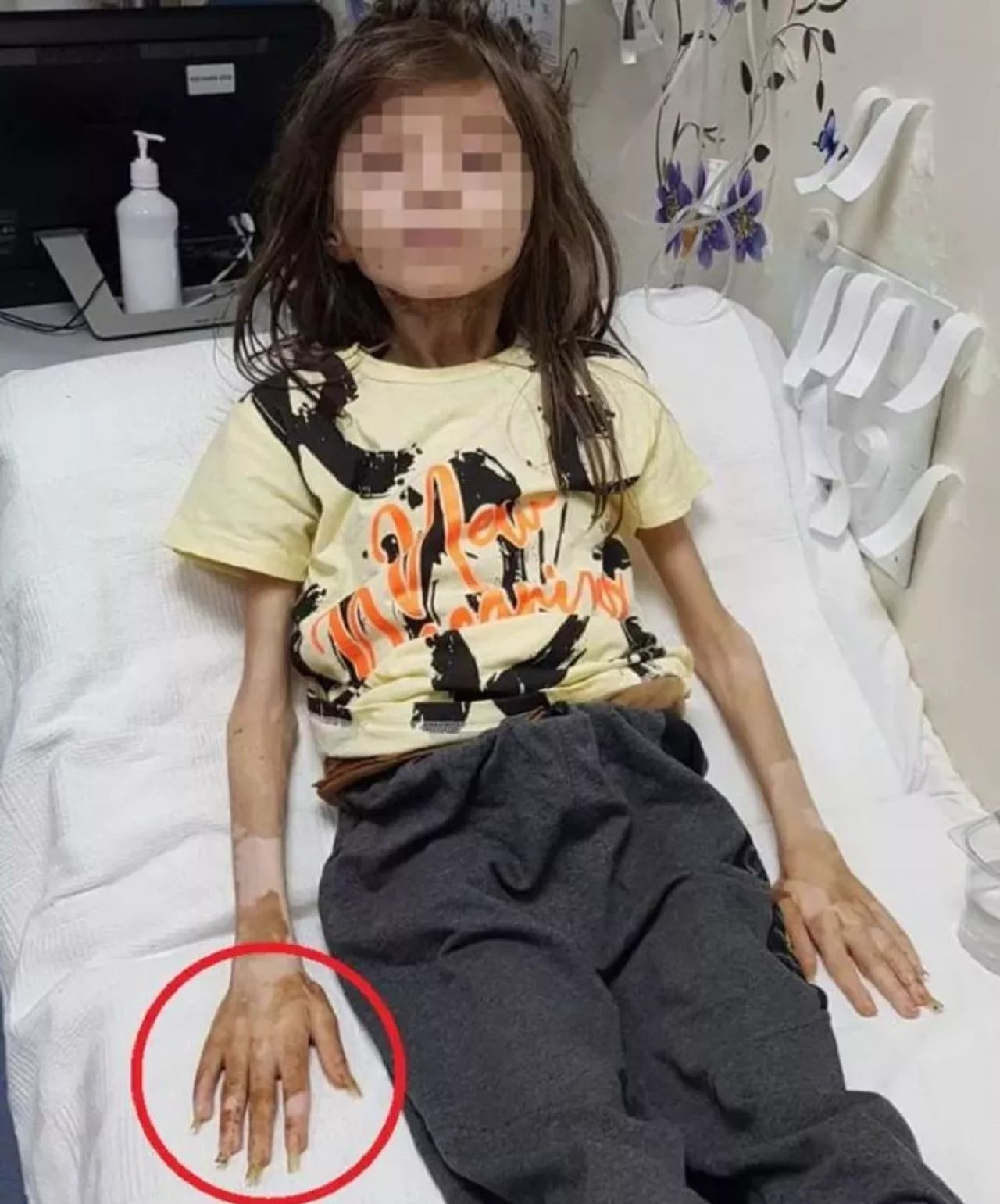 Bursa çöp ev Bursa çöp ev