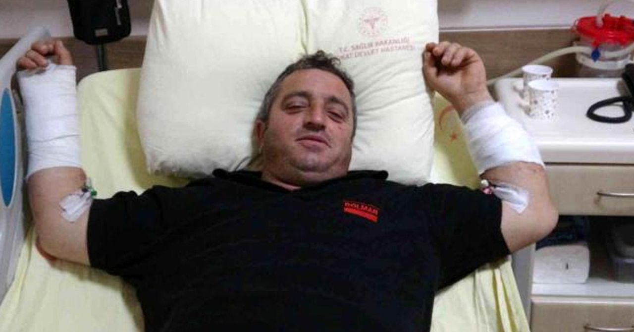 Ayı saldırısına uğrayan adam Ayı saldırısına uğrayan adam
