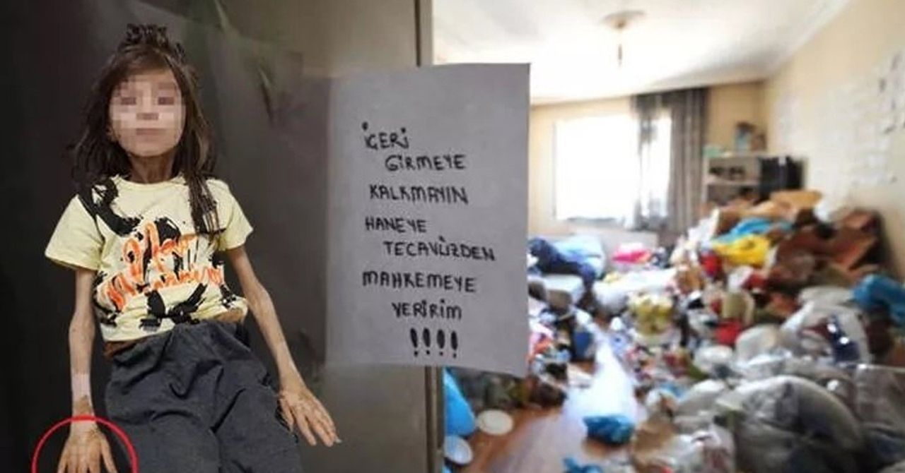 Çöp evde bulunan Muhammet hakkında son gelişmeler Çöp evde bulunan Muhammet hakkında son gelişmeler