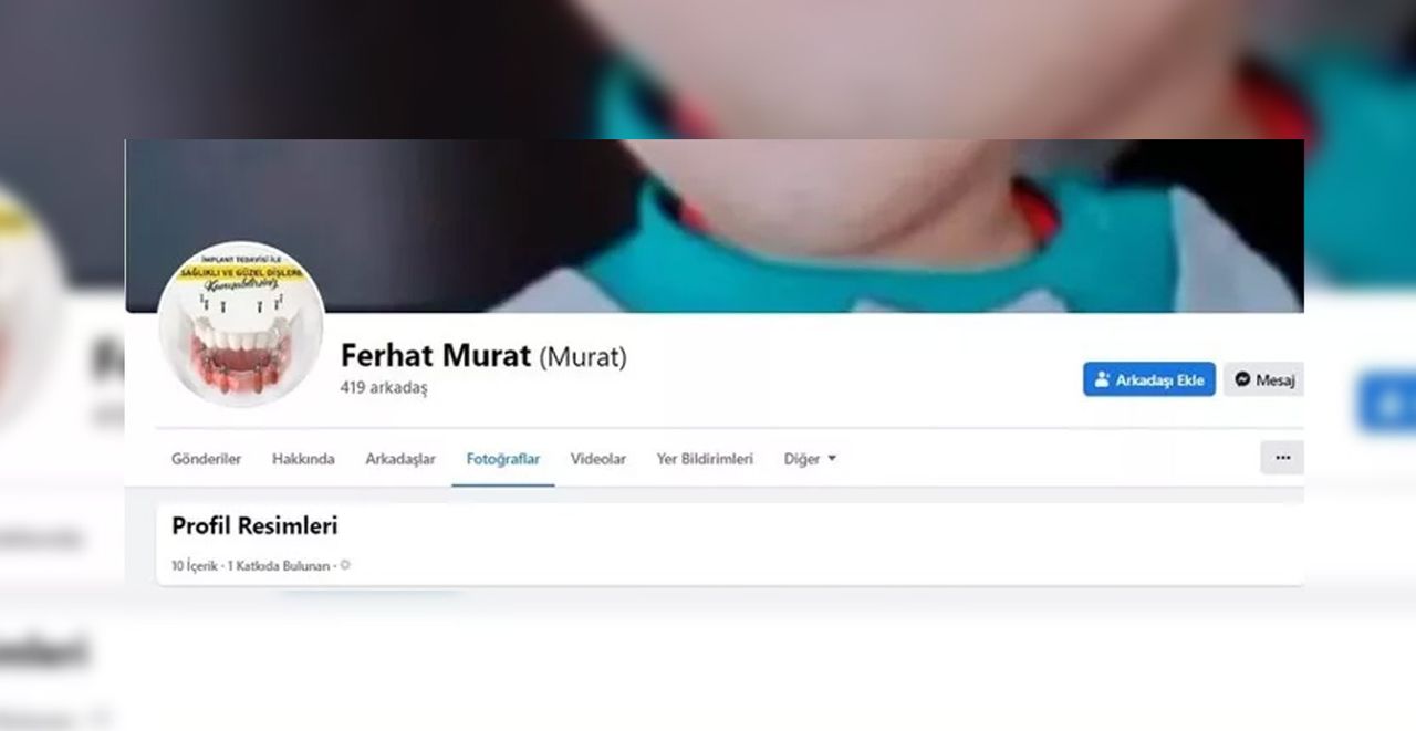 Diş doktoru inşaat işçisi çıktı Diş doktoru inşaat işçisi çıktı