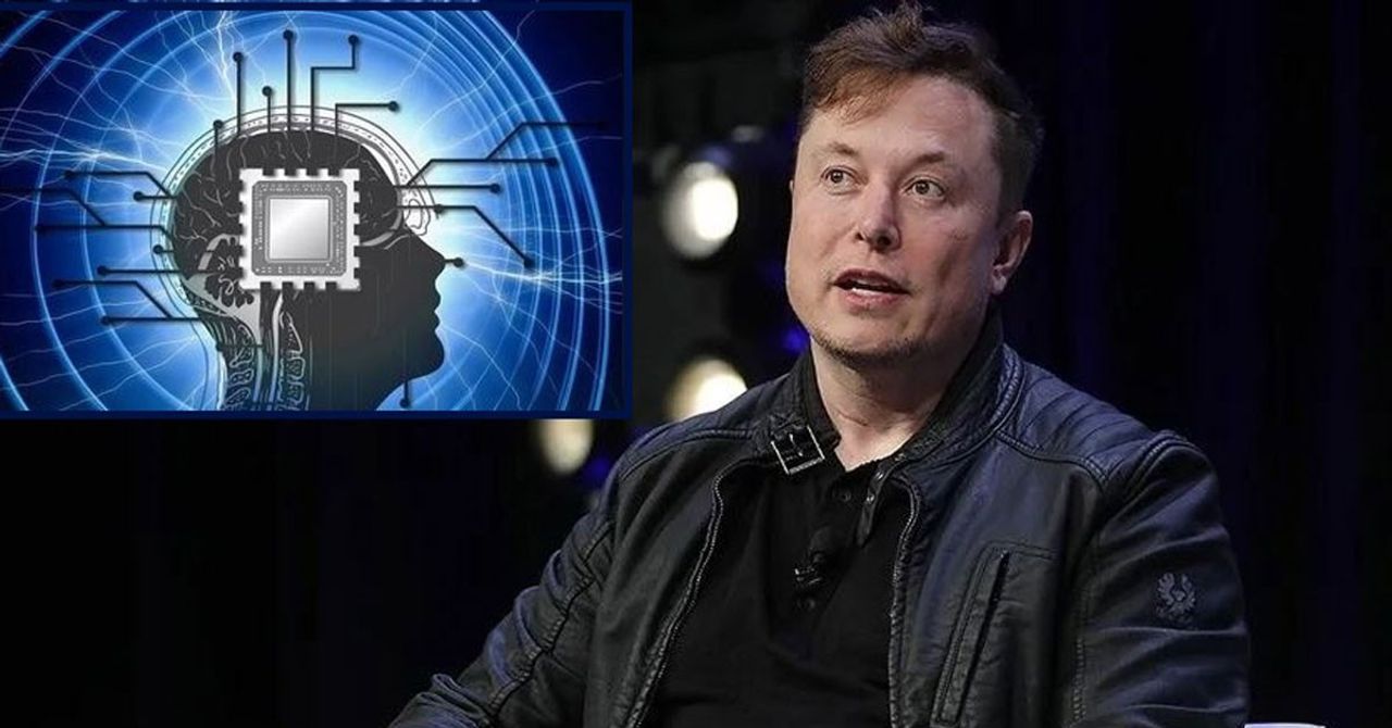 Elon meske beyne çip yerleştirdi Elon meske beyne çip yerleştirdi