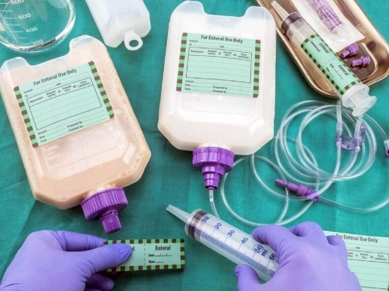 enteral beslenme nedir enteral beslenme nedir