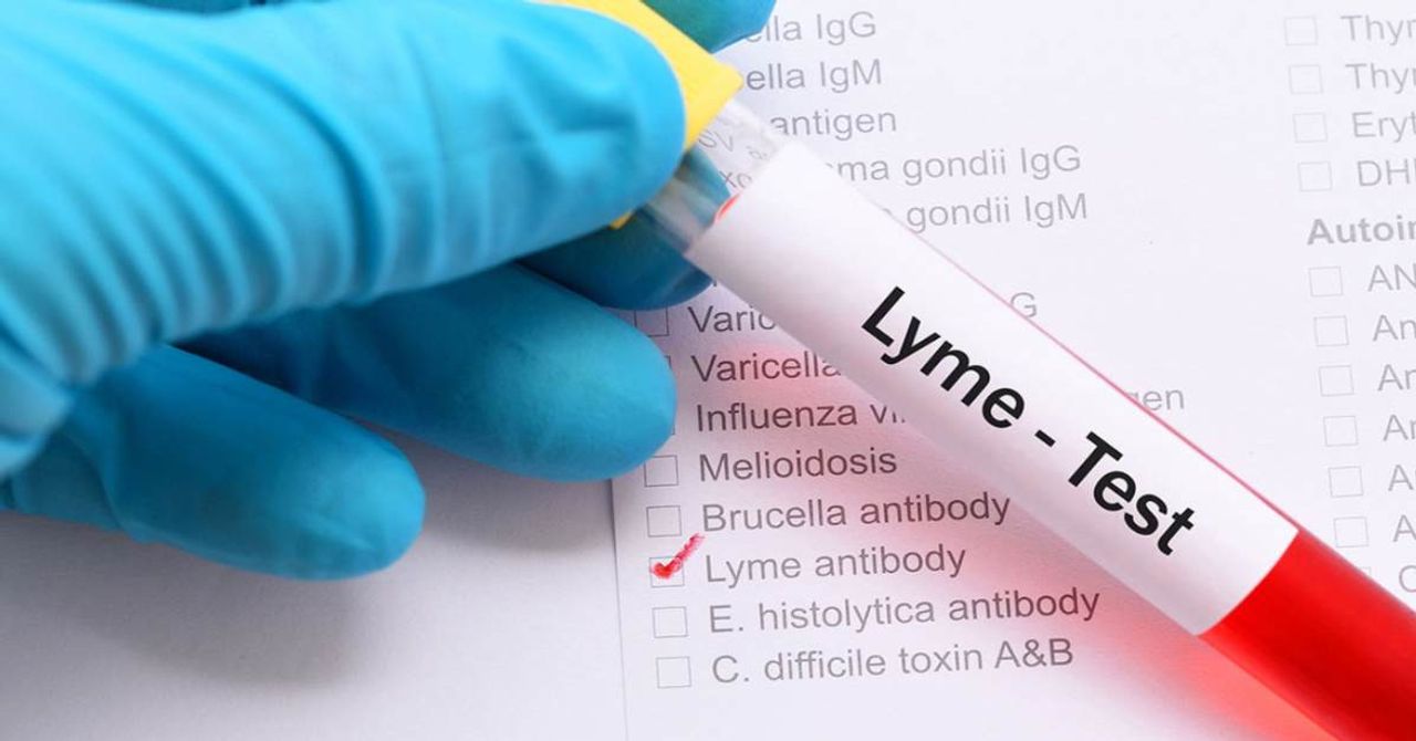 Lyme Hastalığı Lyme Hastalığı
