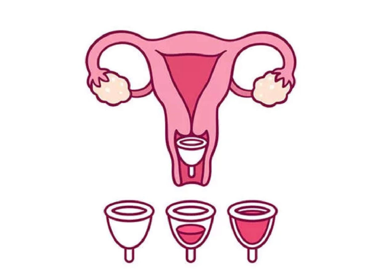 Menstrual kap nasıl kullanılır Menstrual kap nasıl kullanılır