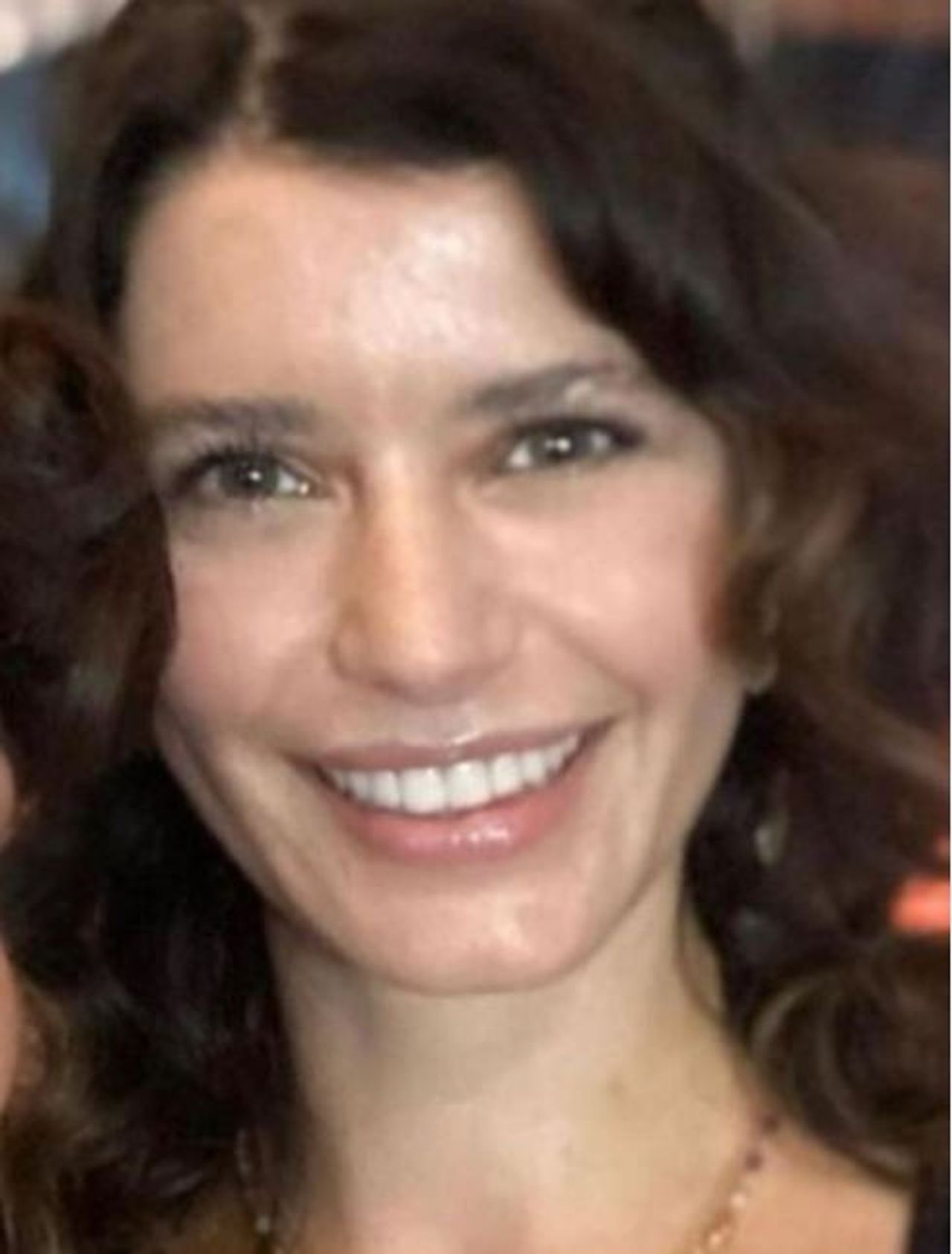 Beren Saat estetik mi yaptırdı? Beren Saat estetik mi yaptırdı?