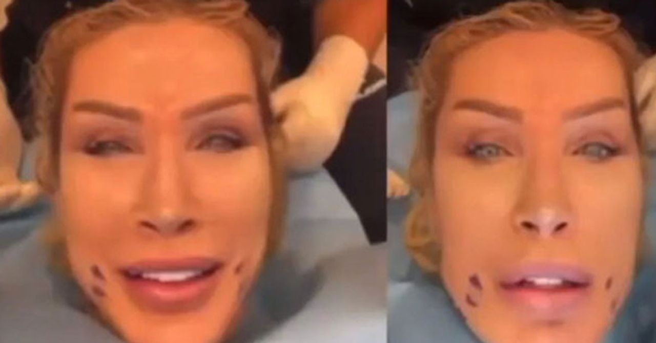 Seda Sayan deeplift yaptırdı Seda Sayan deeplift yaptırdı