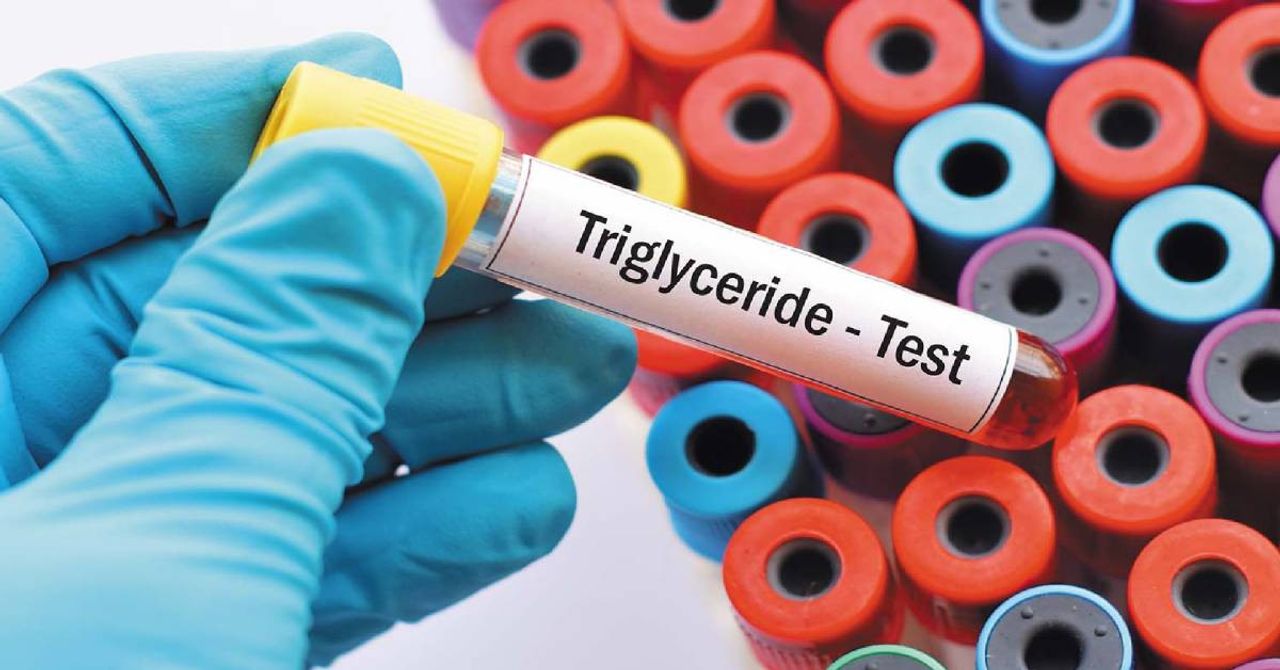 Trigliserid nedir, neden yükselir? Trigliserid belirtileri neler, nasıl düşürülür? Trigliserid tedavisi ve normal değeri Trigliserid nedir, neden yükselir? Trigliserid belirtileri neler, nasıl düşürülür? Trigliserid tedavisi ve normal değeri