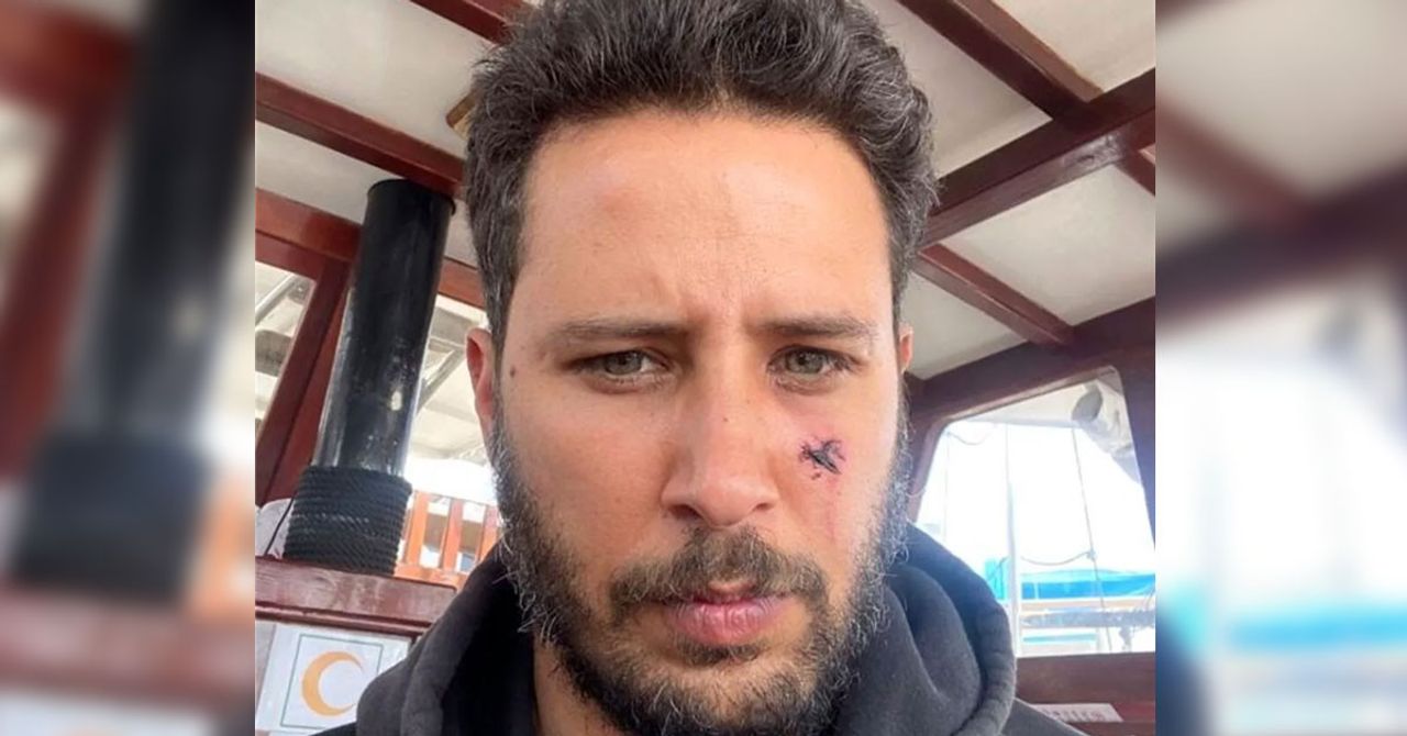 Tuan Tunalı köpek saldırısına uğradı Tuan Tunalı köpek saldırısına uğradı