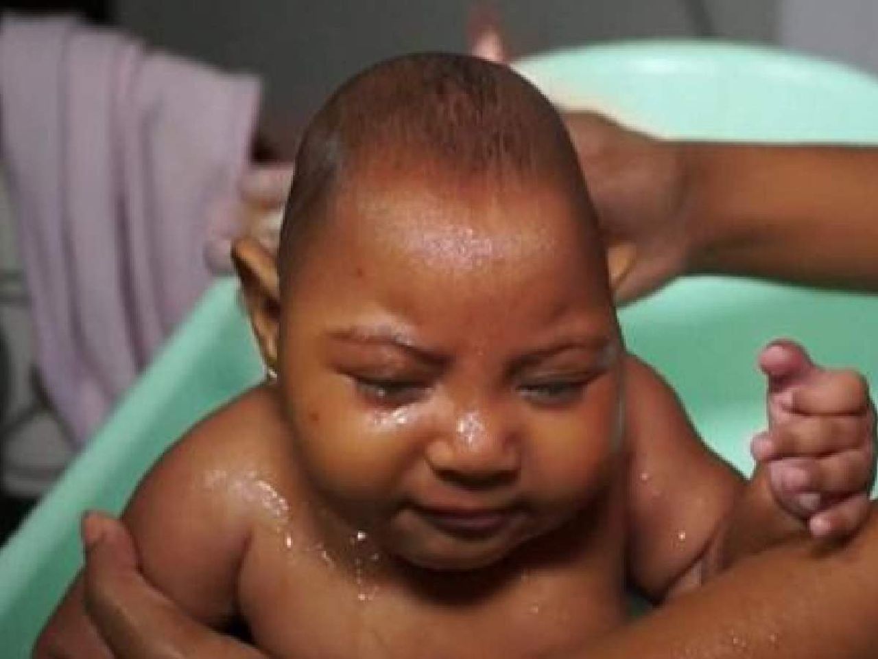 Zika virüsü Türkiye Zika virüsü Türkiye