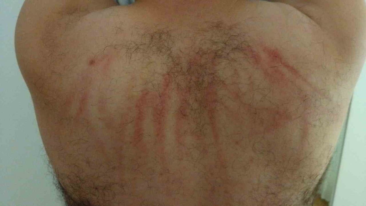 SALİM ÇAKIR, 3 KİŞİ TARAFINDAN EVİNİN ÖNÜNDE BEYZBOL SOPALARIYLA DARP EDİLDİ