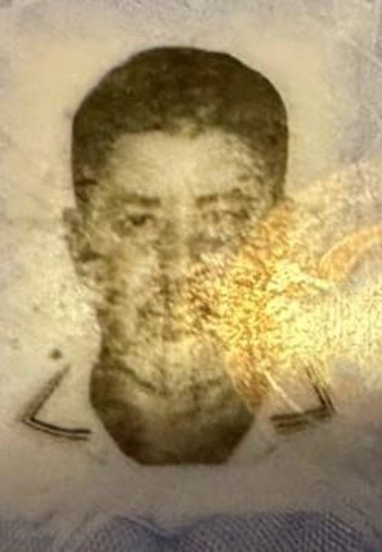 53 YAŞINDAKİ ABDULLAH AKTİZ KALDIRILDIĞI HASTANEDE HAYATINI KAYBETTİ.