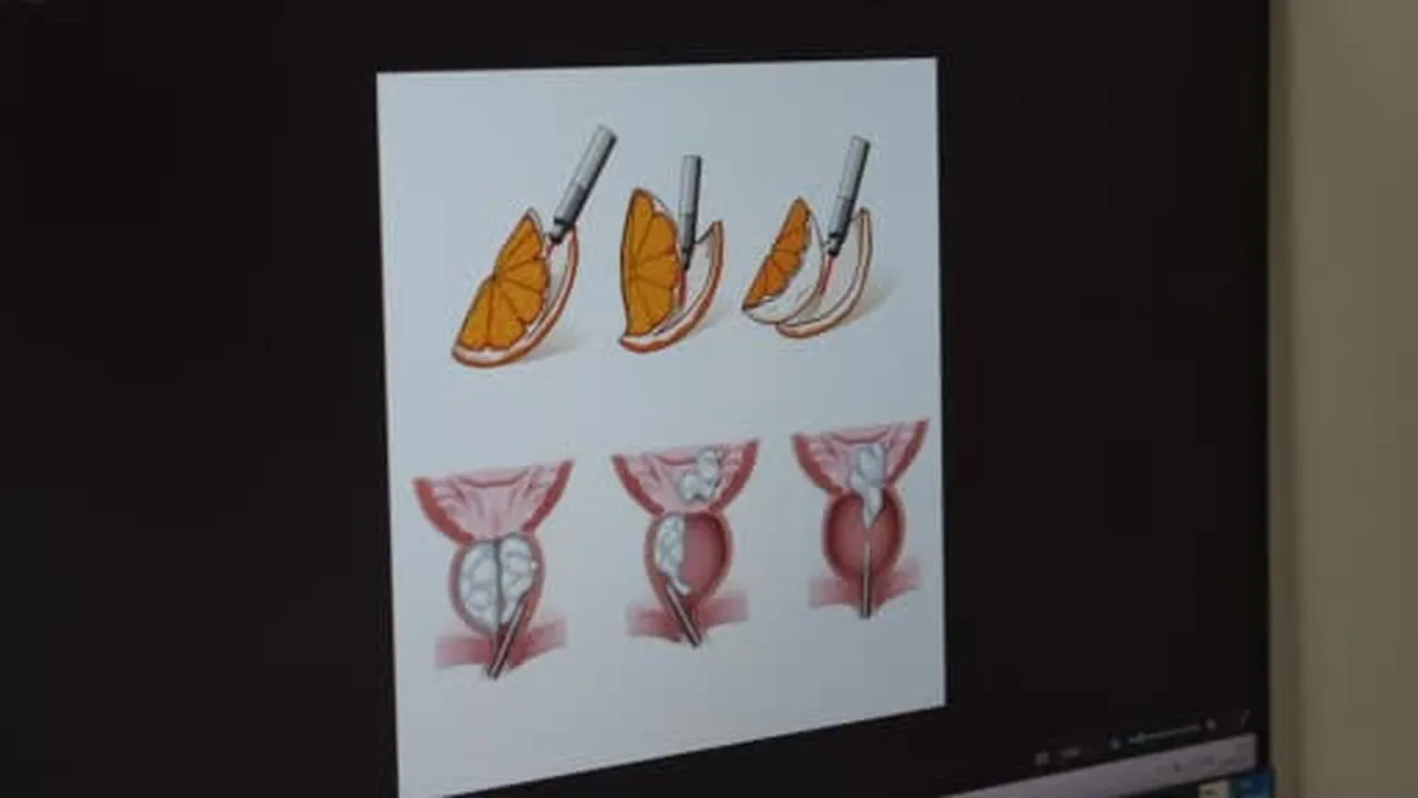 Erkeklerde sinsi tehlike çoğu zaman belirti vermiyor