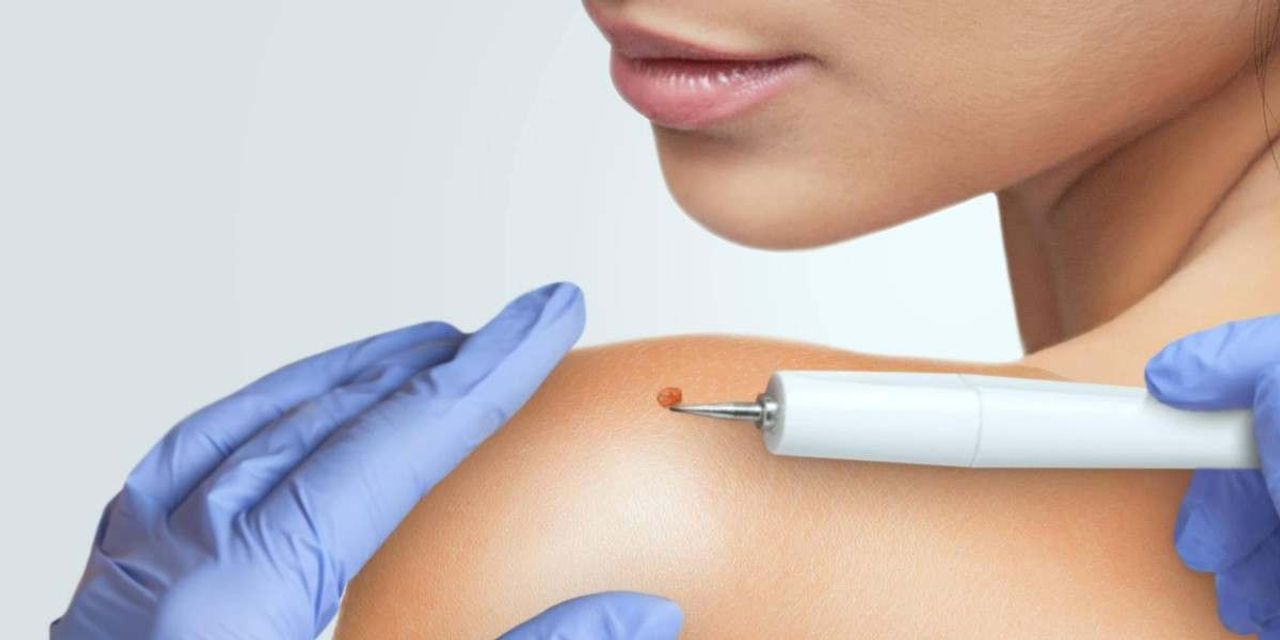 Benler Tehlikeli Mi