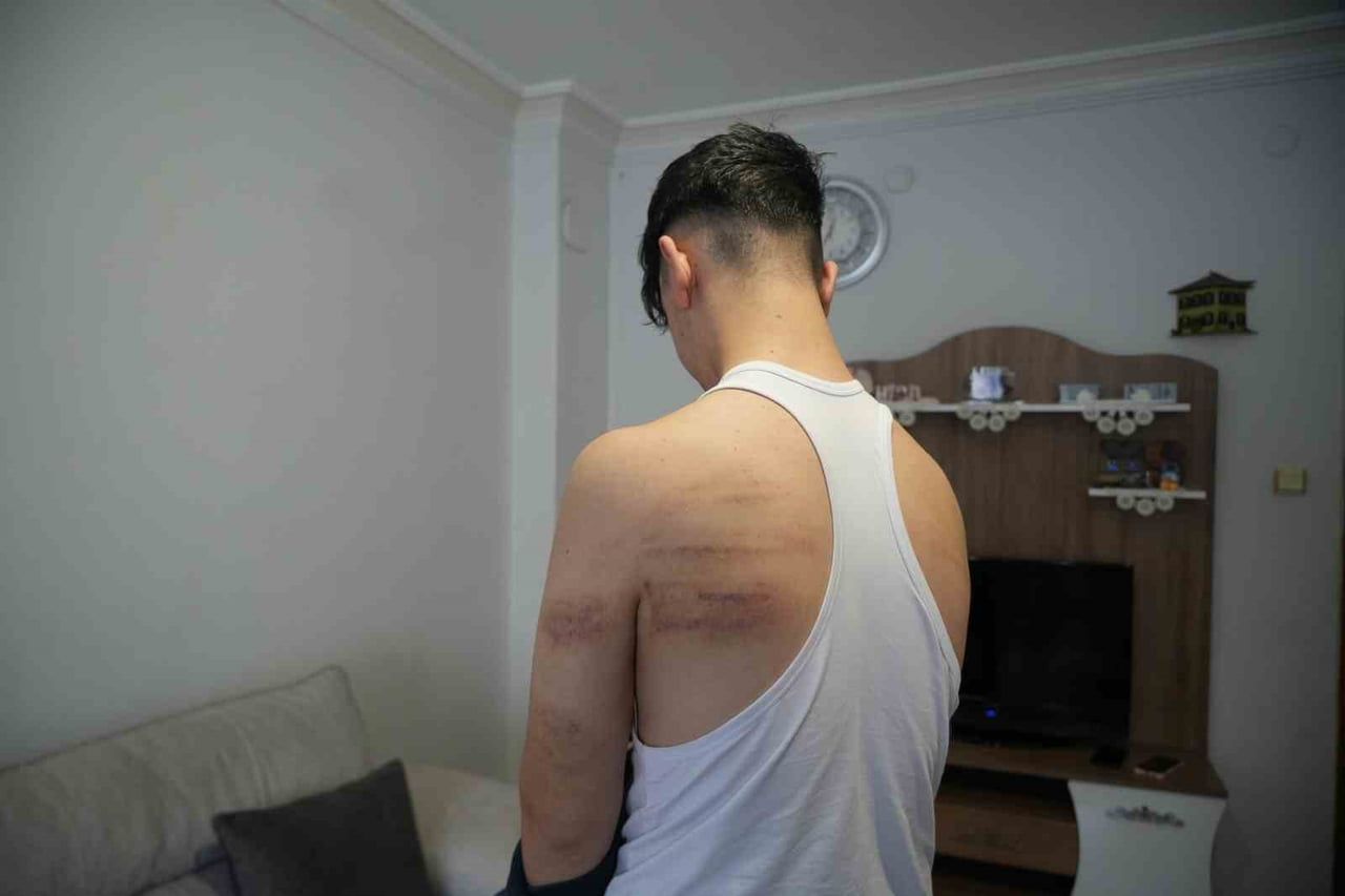 NİĞDE’DE 15 YAŞINDAKİ BERBER ÇIRAĞINA DARP İDDİASI