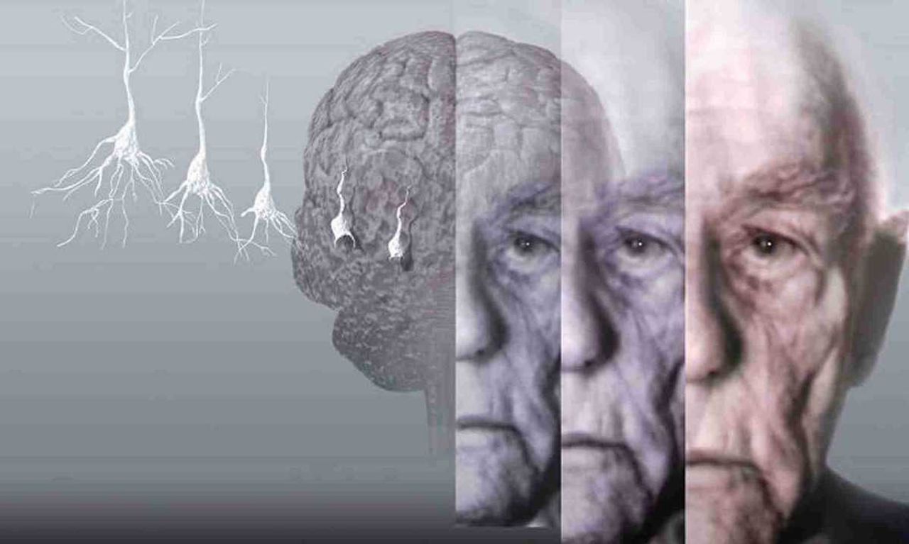 Demans hastalığı nedir