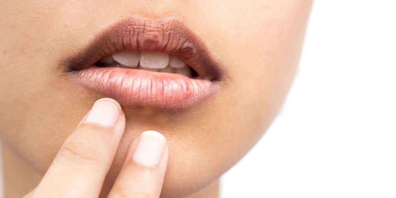 Dudak kuruluğu neden olur?