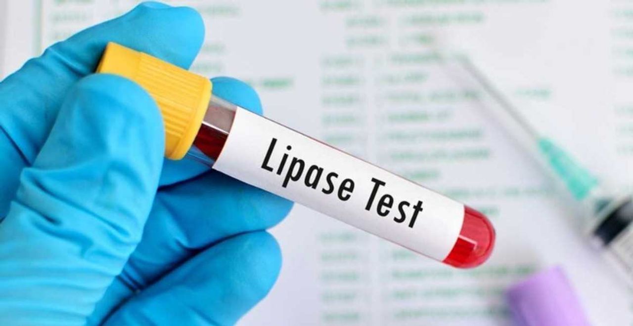 Lipaz değerinin yükseldiği nasıl anlaşılır