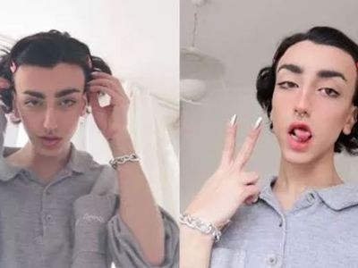 Sosyal medya fenomeni Mika'nın estetiksiz ve estetikli hali gündem olmuştu: Şimdi de Mika'nın bikinili fotoğrafı ortaya çıktı