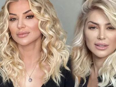 Songül Karlı'nın yeni hali ortaya çıktı! Bıçak altına yatan ünlü oyuncu bakın kime benzetildi