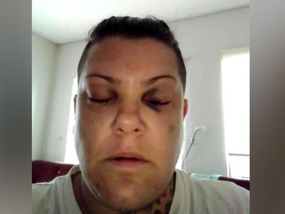 Pop Star yarışması ile adını duyuran Evren Mevlanaoğlu darp edildi! Sebebi ise herkesi şaşkına çevirdi