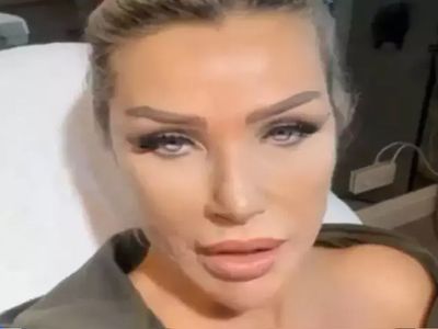 Yüzüne sünnet derisi enjekte etmişti! Seda Sayan'ı öyle bir isim aradı ki: Ben de istiyorum!