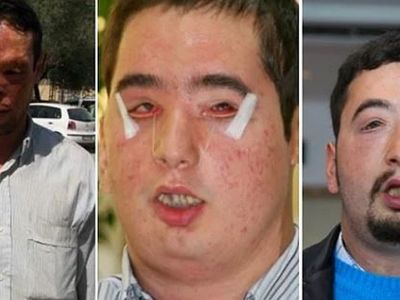Yüz Nakliyle Yeni Bir Görünüme Sahip Olan İnsanlar
