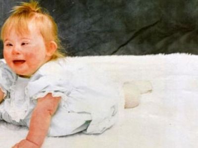 Vicdansız anne down sendromlu kızını aç bırakarak öldürdü