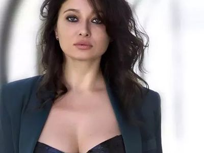 Nurgül Yeşilçay'ın kazadan sonraki hali yürek dağlıyor