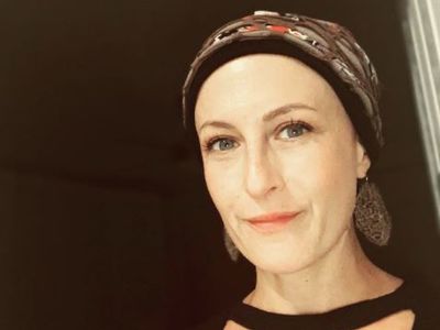 Kanser Tedavisi Gören Canan Ergüder İmaj Değiştirdi!