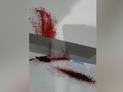 Görüntüleri daha da ürkütücü! Yeni taşındıkları evin duvarlarından kan sızdığını gören aile panik oldu