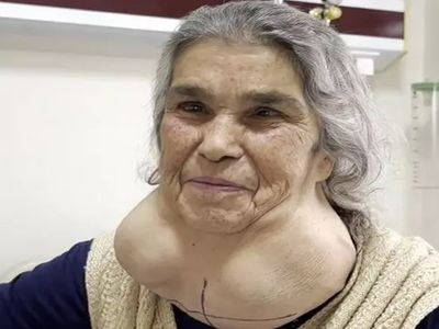 Boynunu gören uzmanlar dondu kaldı: Denizli'de ilginç olay! Doktor korkusuyla hastaneye gitmeyince...