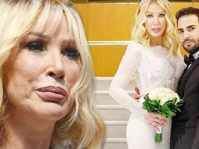 Estetiksiz haliyle gündeme gelen Seda Sayan genç eşi Çağlar Ökten’e yetebilmek için öyle bir yerine estetik yaptırdı ki...