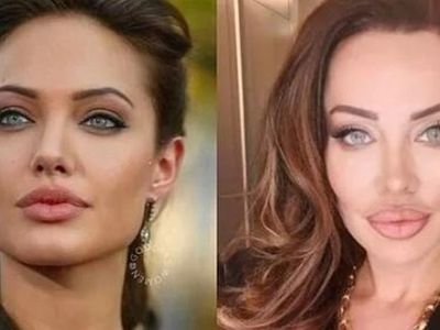 Yerli Adriana Lima Umut Akyürek güzelleşmek için yüzüne sülük yapıştırdı bin pişman olan Akyürek'in o hali herkese ders oldu