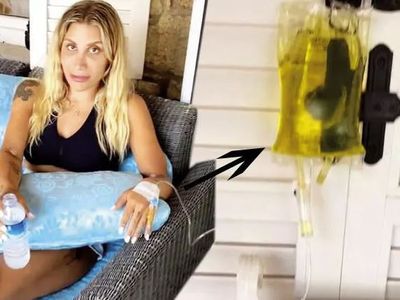 İrem Derici Çeşme Tatilinde Hastanelik Oldu! Haberi Sosyal Medyadan Paylaştı