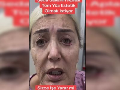 Seda Sayan bu kez de ablasına estetik yaptırdı! Son halini görenler dondu kaldı...