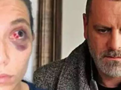 Ozan Güven'in eski sevgilisi Deniz Bulutsuz'u darp ettiği davada son gelişme: Adli Tıp Kurumu raporu hazırladı