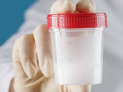 Sperm bankası nedir, Türkiye'de neden yasak?