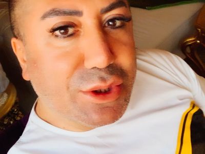 Murat Övüç İlk Eşiyle Neden Evlendiğini Açıkladı!