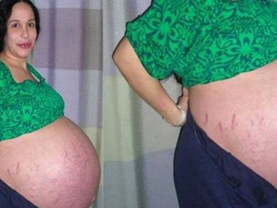 14 Çocuk Doğurdu, Doğum Sonrası Halini Görenler İnanamıyor!