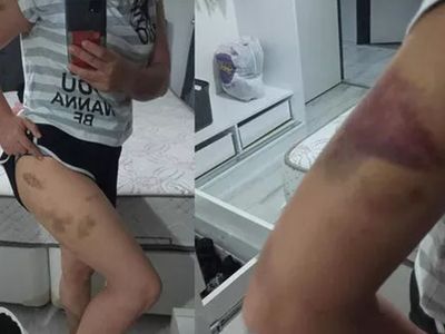 Öz annesi para karşılığında sattı! Hayatı kabusa döndü! İşte talihsiz kadının yürek burkan hikayesi... 