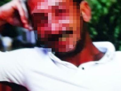 Antalya'da Eğlendiği Kadını Önce Bıçakla Tehdit Etti Sonra da Saldırıda Bulundu